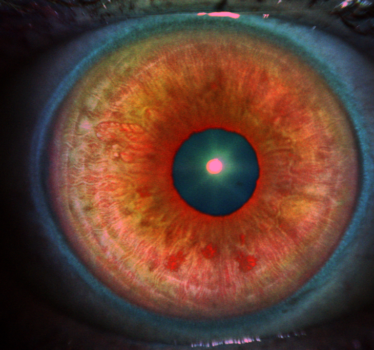 1904 iris scan infrared